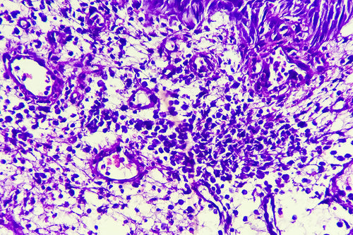 腸内細菌、ムチンの住人