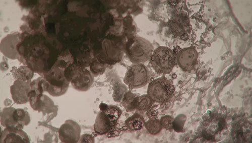 デスルフォビブリオ属_自閉症