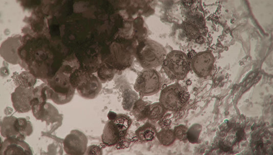 デスルフォビブリオ属_自閉症